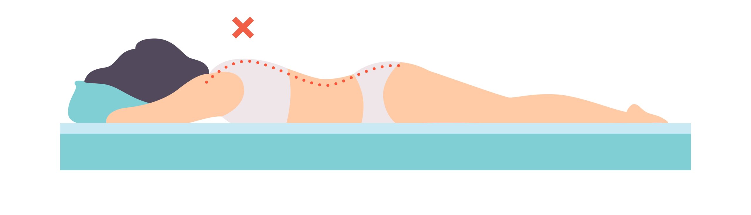 A poor stomach sleeping position for lower back pain